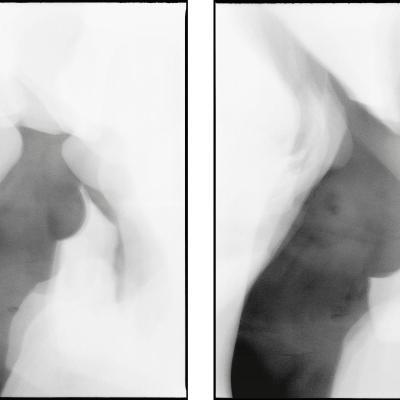 Tunyogi Henriett I - III.